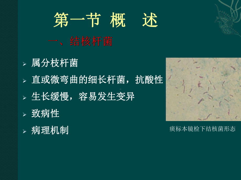 第二十六章结核病课件.ppt_第3页