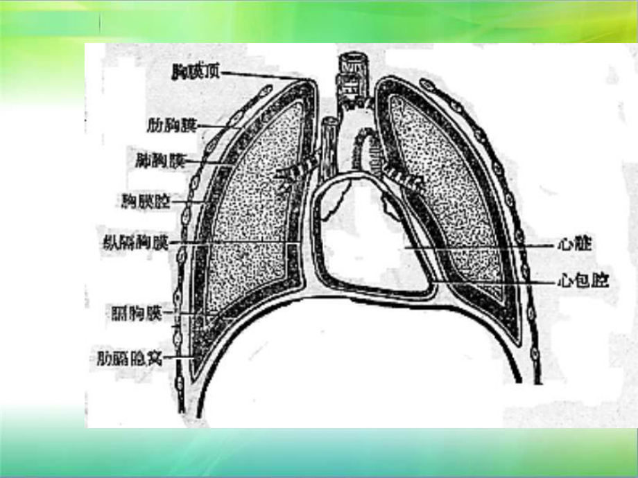 新胸外科疾病解析课件.ppt_第3页