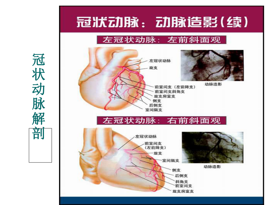 冠状动脉粥样硬化性心脏病(同名843)课件.ppt_第3页