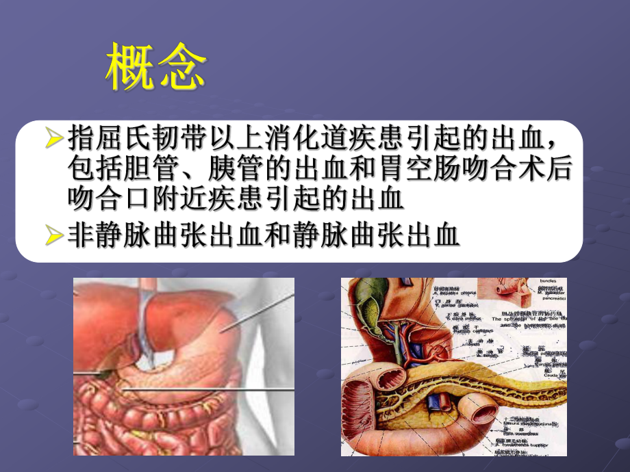 朱峰上消化道出血的诊治基础和进展课件.ppt_第2页