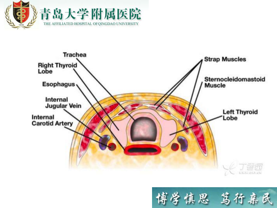 甲状腺病变的超声诊断与细针穿刺技术课件.ppt_第3页