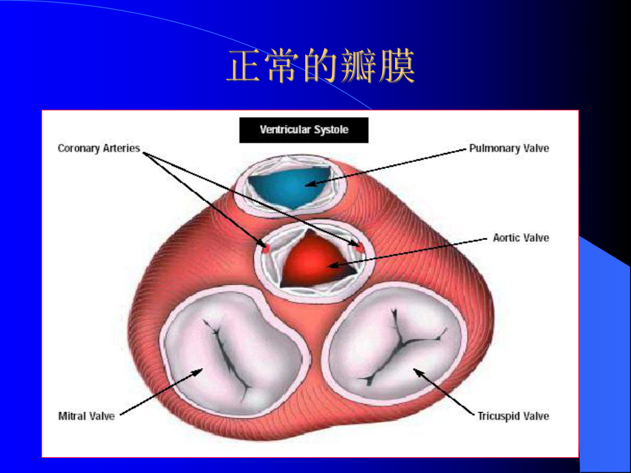 心脏瓣膜病课件教用.ppt_第2页