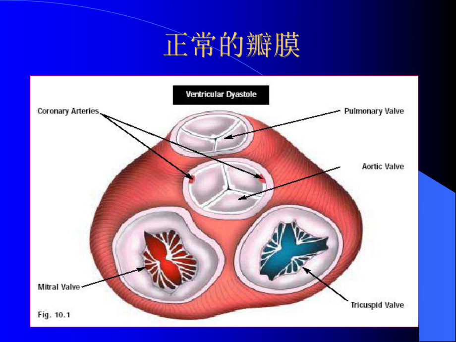 心脏瓣膜病课件教用.ppt_第3页