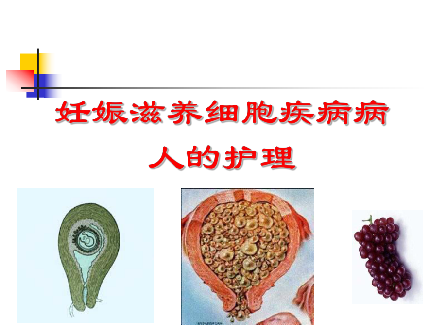 滋养细胞疾病的护理课件讲义.ppt_第2页