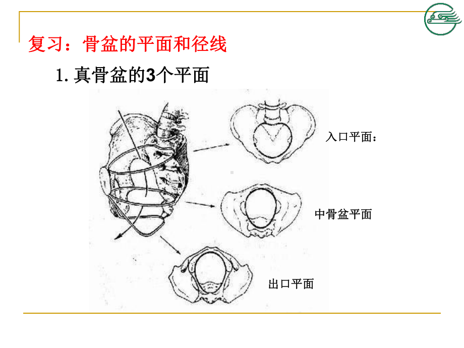 第九章产道异常胎儿异常课件.ppt_第3页