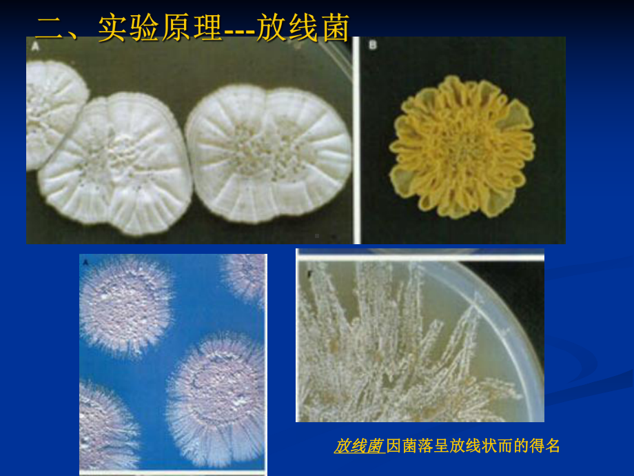 微生物实验四放线菌、霉菌、酵母菌的形态观察课件.ppt_第3页