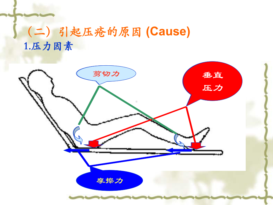 压疮分期与预防措施课件.ppt_第3页