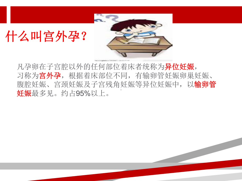 宫外孕个案护理课件讲义.ppt_第2页