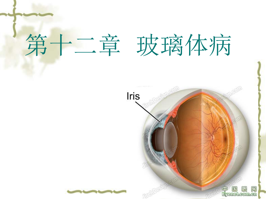 第十二章玻璃体病课件.ppt_第1页