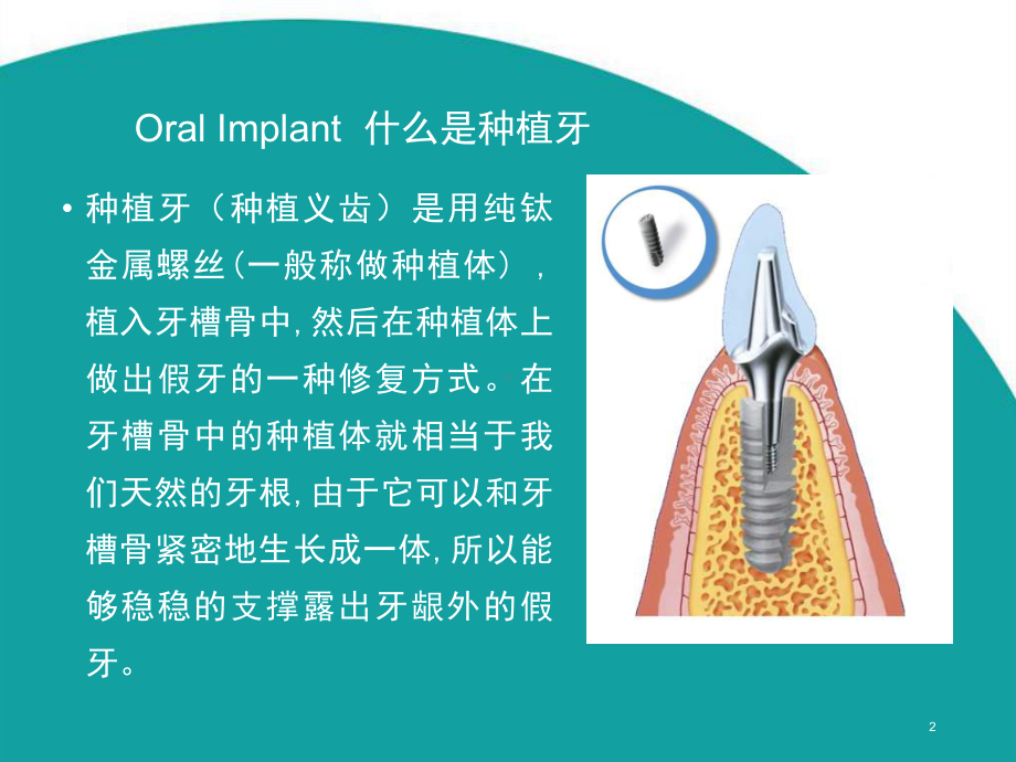 口腔种植简介课件.pptx_第2页