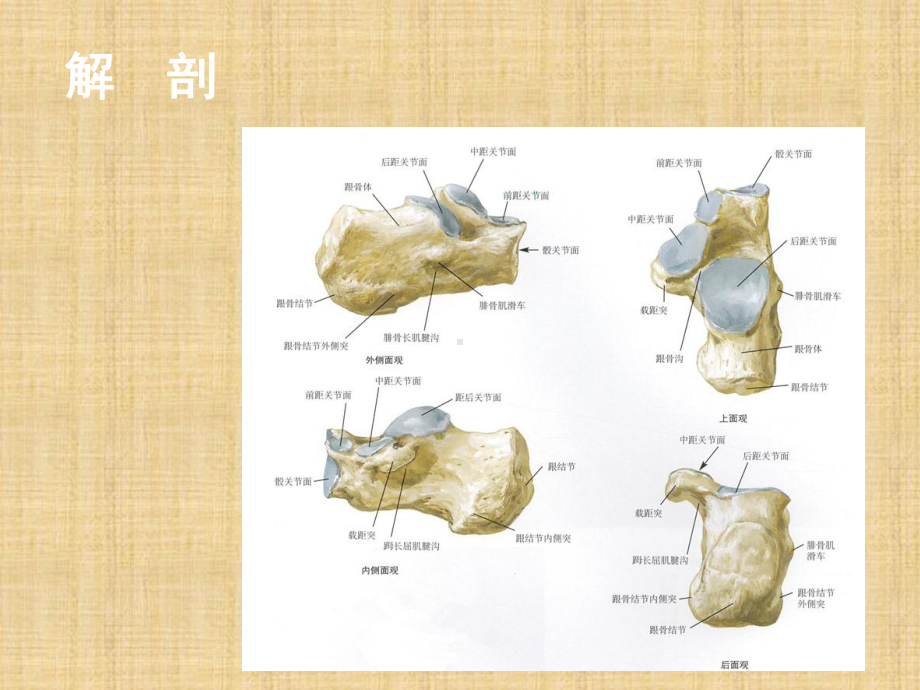 跟骨骨折的手术治疗课件.ppt_第3页