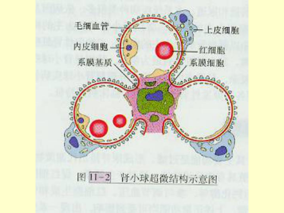 病理学课件泌尿系统疾病.ppt_第3页