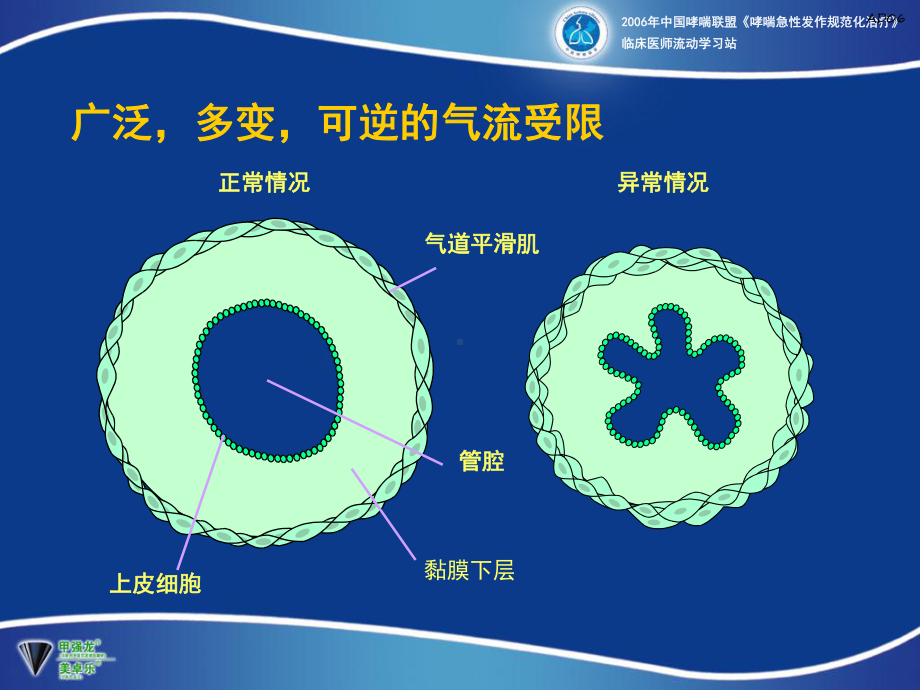 支气管扩张剂在支气管哮喘急性发作时的应用课件.ppt_第2页