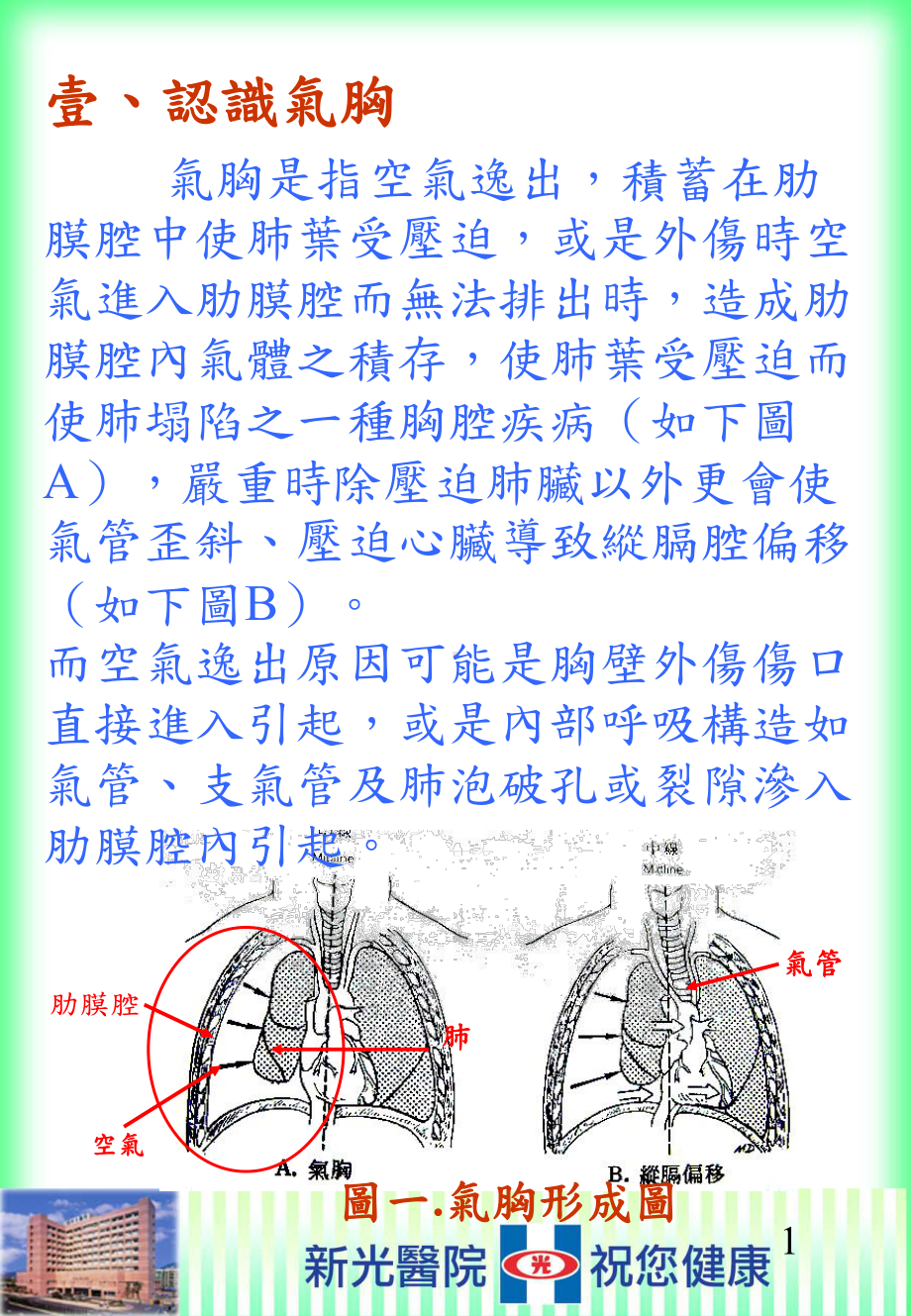 气胸护理指导手册课件.ppt_第3页