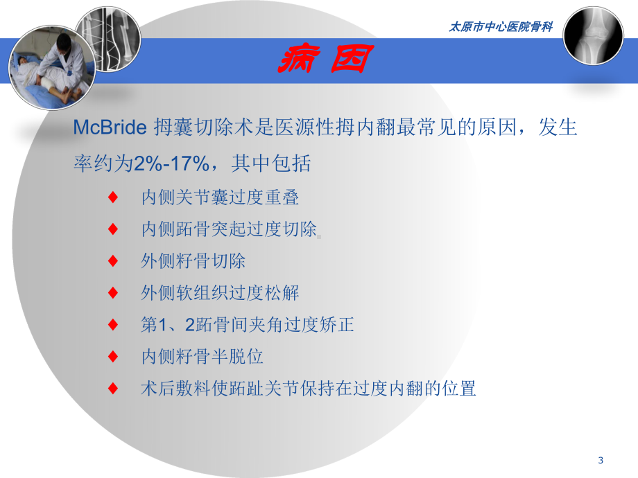 医源性拇内翻课件.ppt_第3页