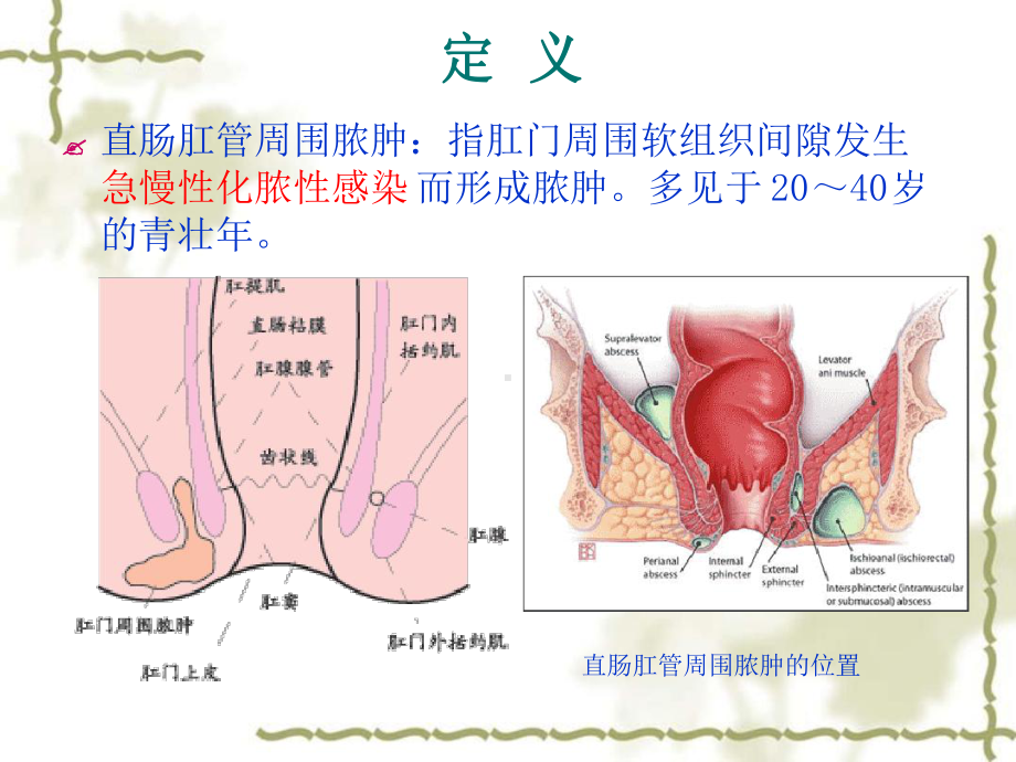 肛周脓肿的诊断与治疗课件.ppt_第3页