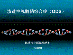 渗透性脱髓鞘综合症课件.ppt