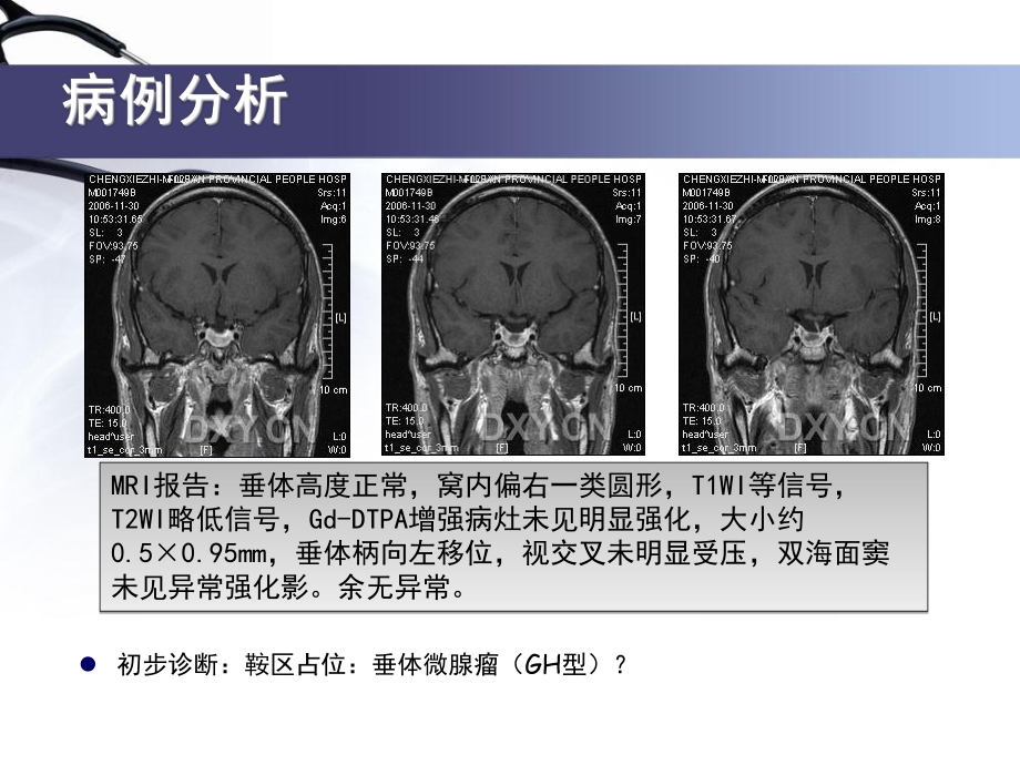 垂体瘤培训课件.ppt_第3页