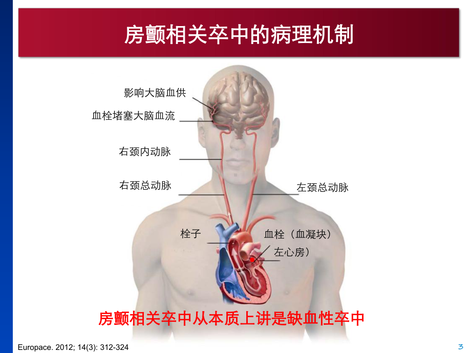 房颤相关缺血性卒中预防20141126(指南更新)课件.pptx_第3页