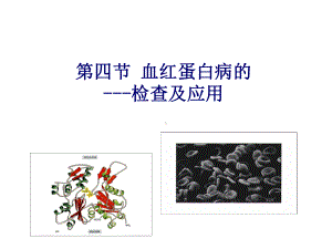 第九章血红蛋白病和免疫性溶血性贫血检查课件.ppt