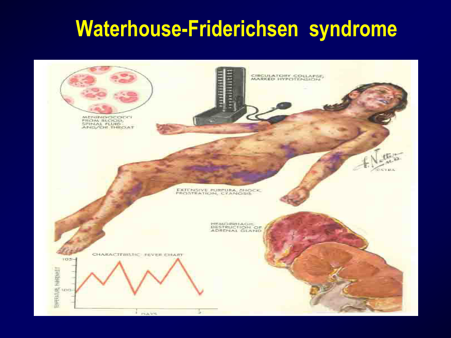 弥散性血管内凝血Disseminated Intravascular Coagulation1课件.ppt_第2页