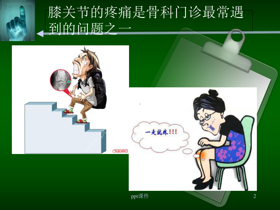 膝关节疼痛的诊断与治疗课件讲义.ppt_第2页