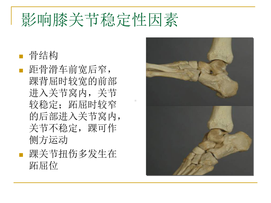 踝关节损伤骨科课件.ppt_第3页