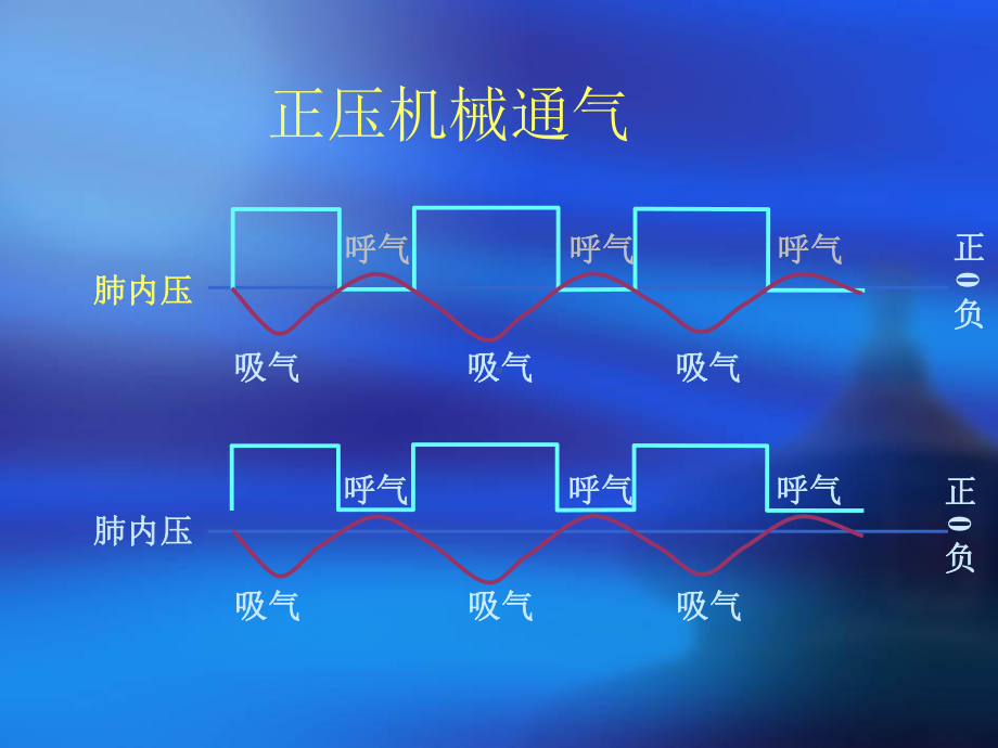 压控与容控课件.ppt_第2页