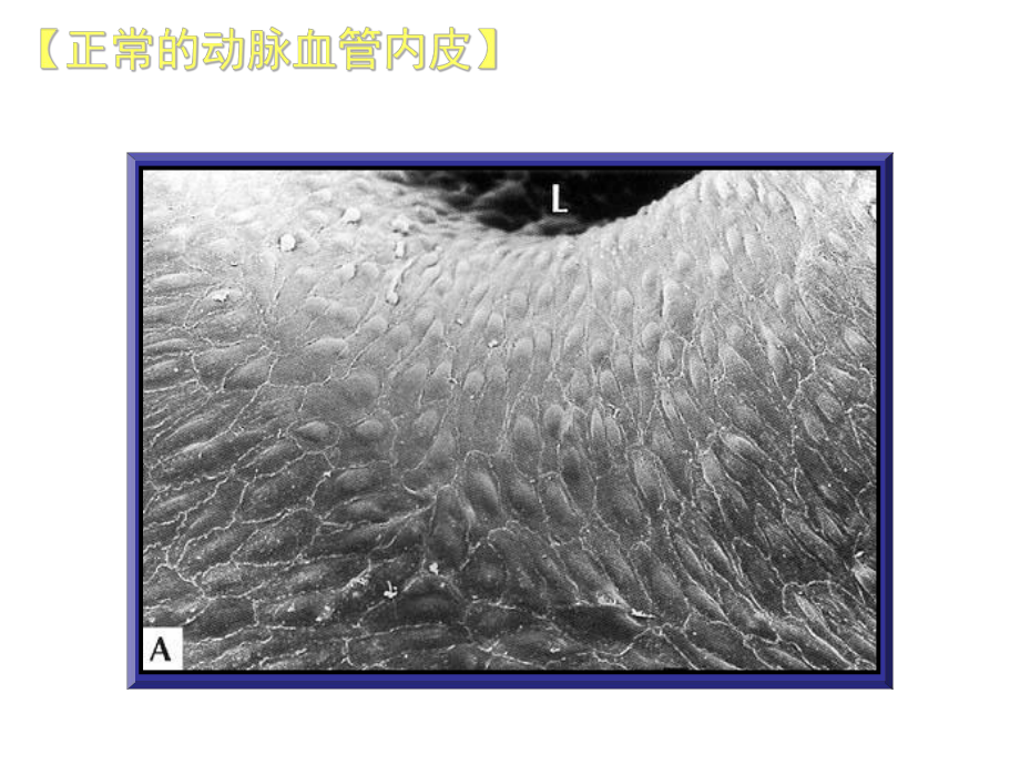 动脉粥样硬化性疾病防治课件讲义.ppt_第2页