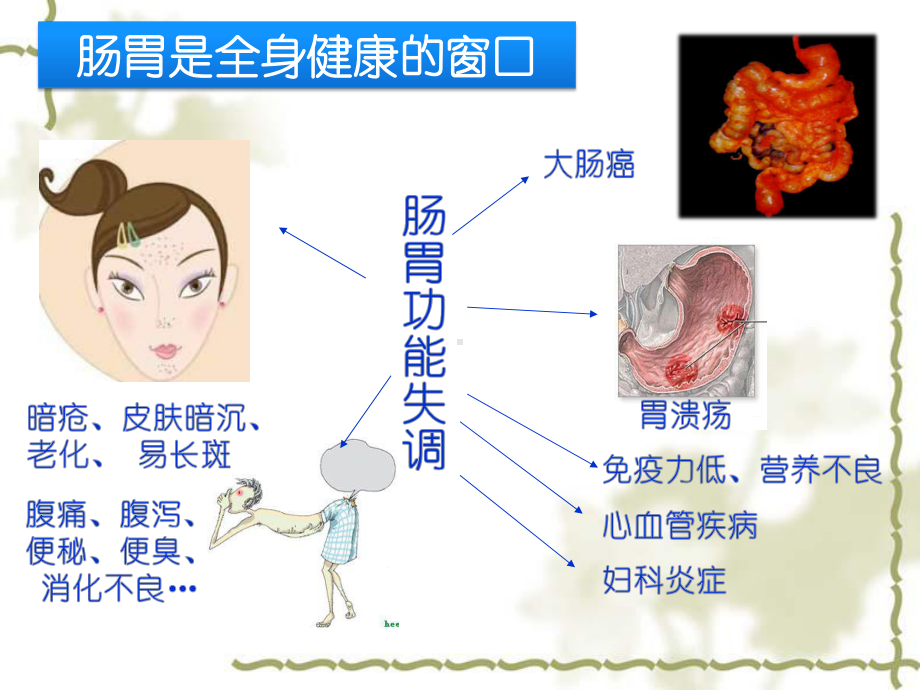 三肠道健康-课件.ppt_第3页