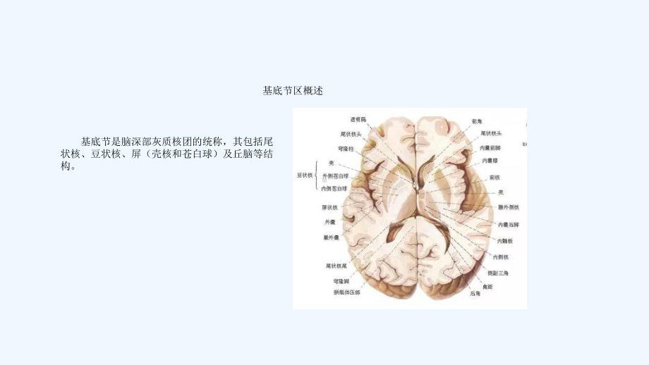 基底节病变袁振国课件.ppt_第2页