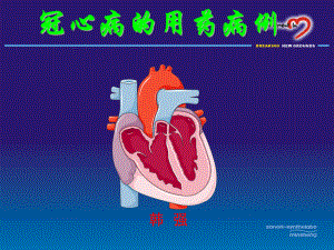 冠心病的用药病例课件.ppt