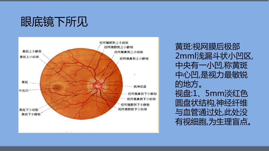 黄斑水肿护理查房课件.pptx_第2页