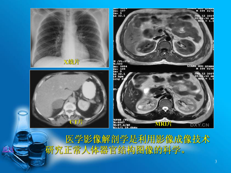 医学影像学各种成像原理及应用(GLN)课件.pps_第3页