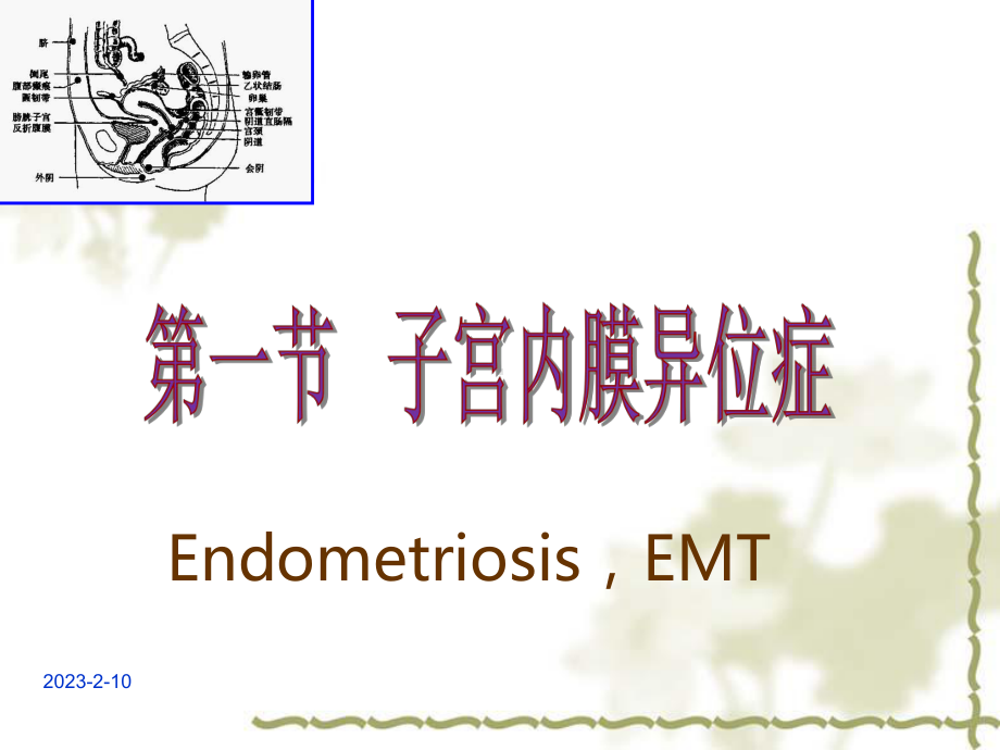 (完成)子宫内膜异位症课件.ppt_第3页