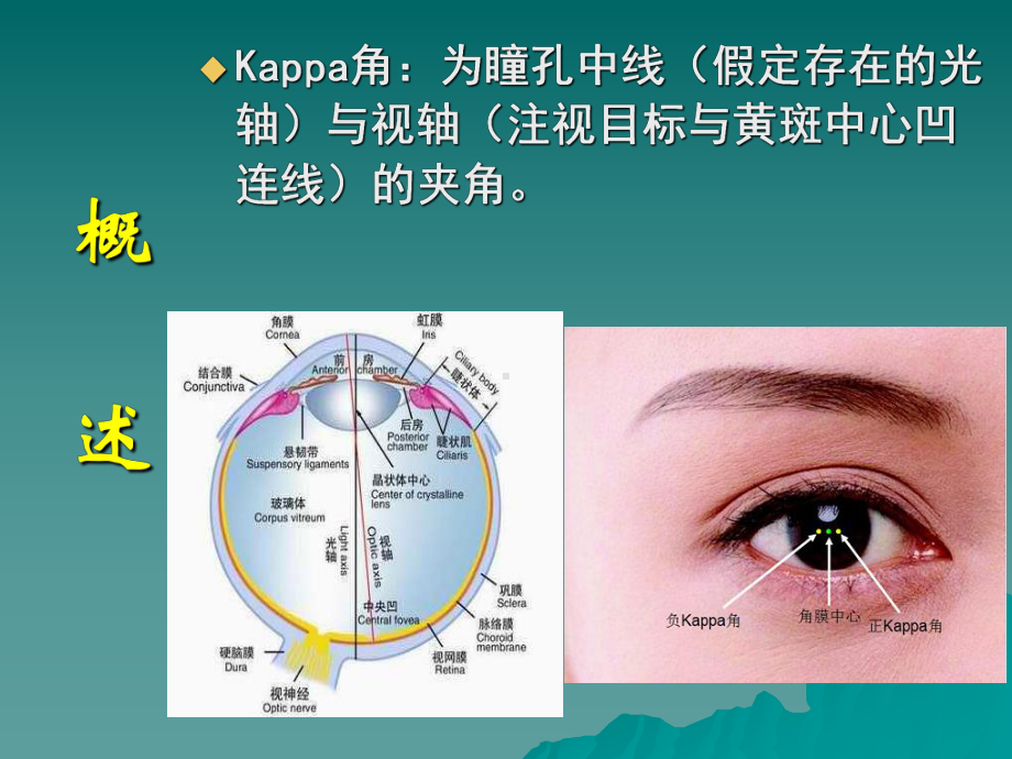 斜视与弱视(斜弱视)(新)课件.ppt_第3页