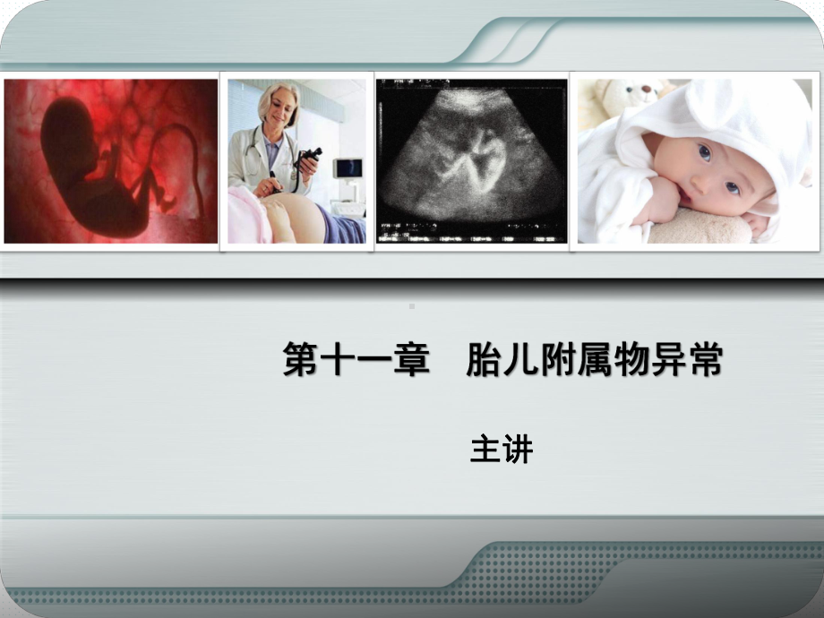 产科前置胎盘课件.ppt_第1页