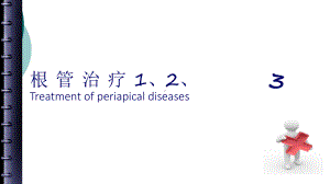 根管治疗的步骤、方法、器械课件2.ppt