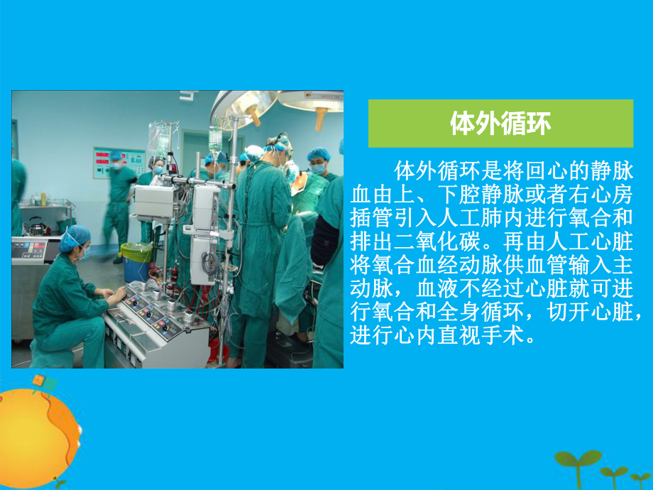 先心病封堵技术课件.ppt_第2页