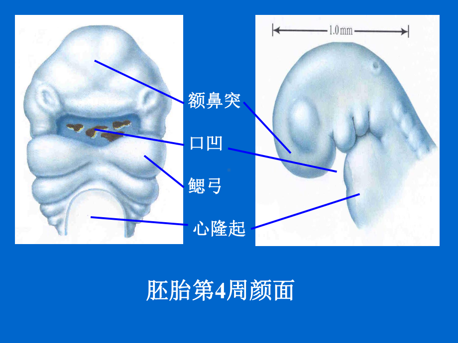 颜面四肢发生课件.ppt_第3页