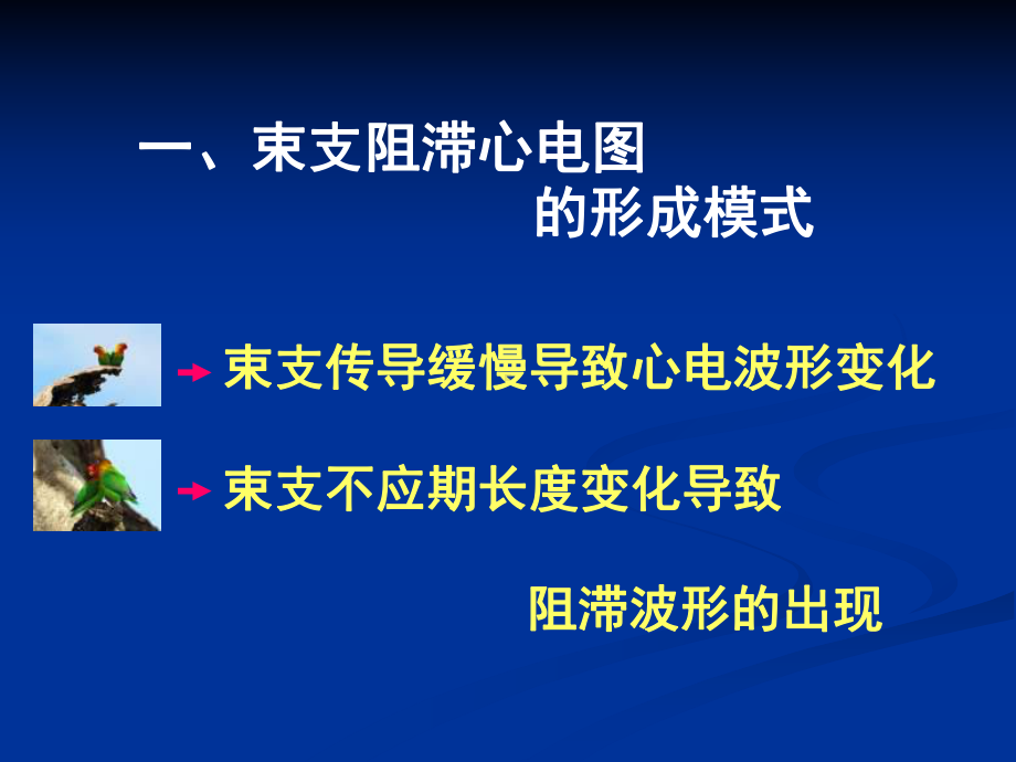 关于束支阻滞特殊心电现象的解析王永权课件.ppt_第2页