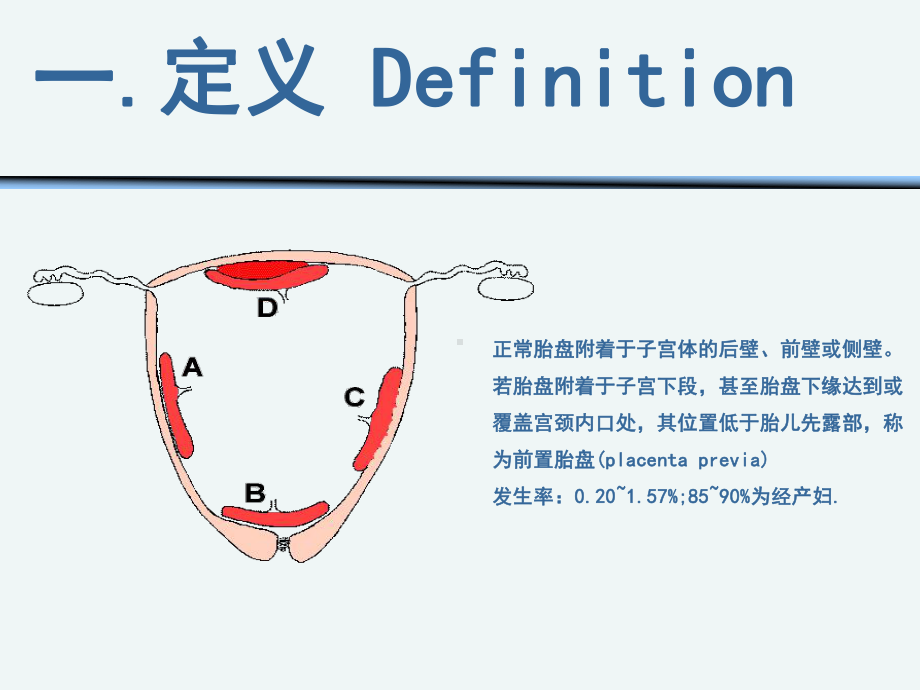 高校 前置胎盘护理课件.ppt_第3页