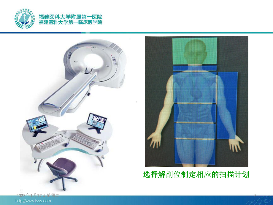 各部位的CT扫描技术参考课件.ppt_第3页