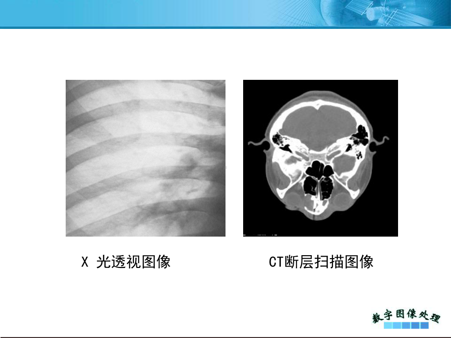 《图像重建》课件.ppt_第3页