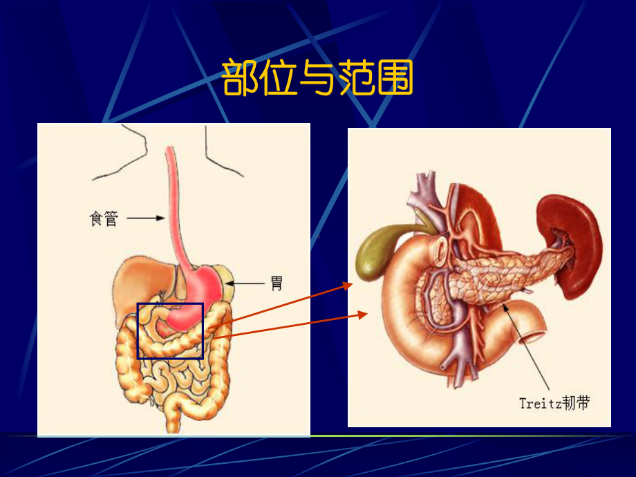 消化道出血急诊学课件.ppt_第3页