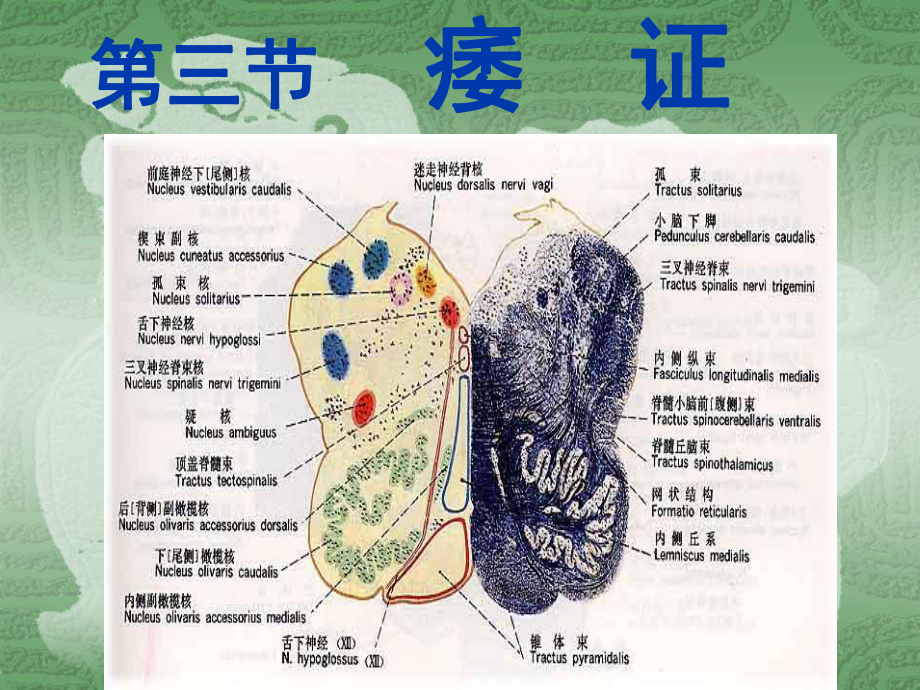 中医内科学痿证课件.ppt_第1页