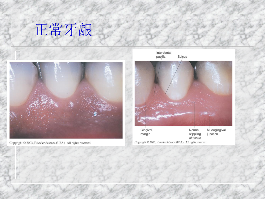 《牙周组织病》课件-.ppt_第2页