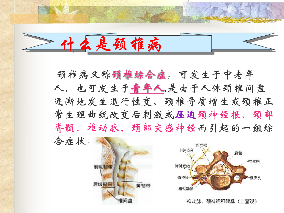 颈椎病保健操医学课件.ppt_第2页