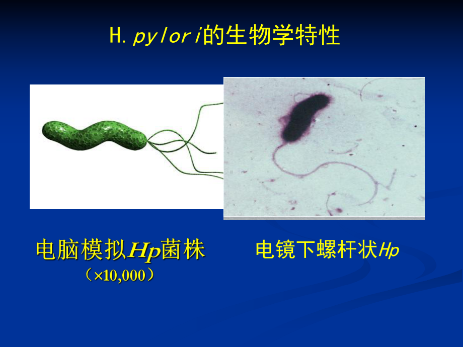 Hp感染的诊断方法课件.ppt_第2页