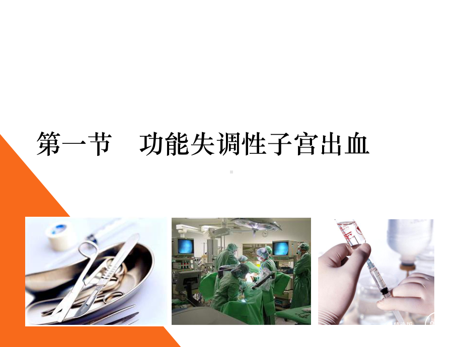 女性生殖内分泌疾病病人的护理课件.ppt_第2页